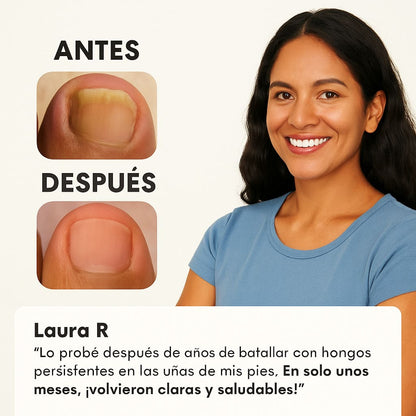 Cero Hongo Plus® – Fórmula avanzada contra hongos